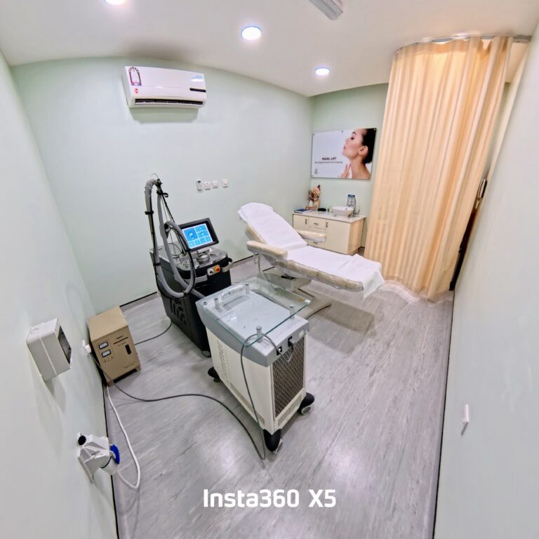 laser room angle 2